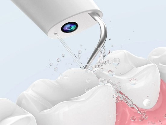 Легкое удаление зубного камня